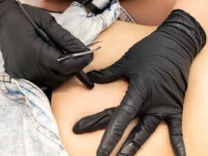 epilazione schiena donna con pinzette