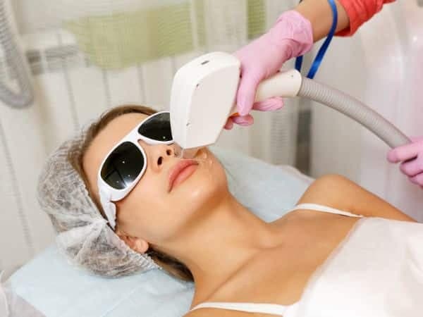 laser depilazione viso