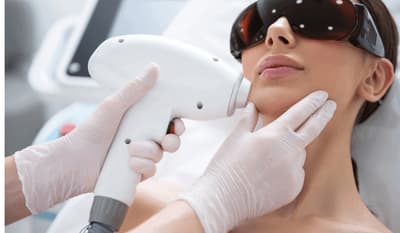 epilazione professionale