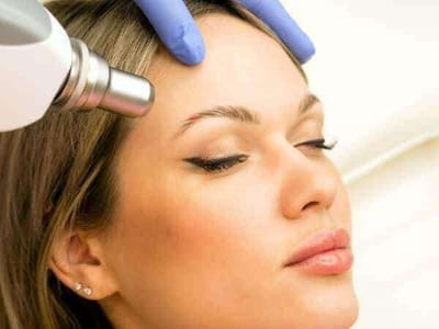 depilazione definitiva su viso donna