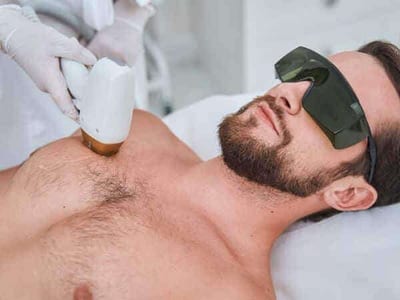 depilazione definitiva uomo